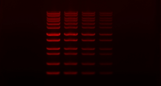 Zobrazovací systém pro elektroforézu
